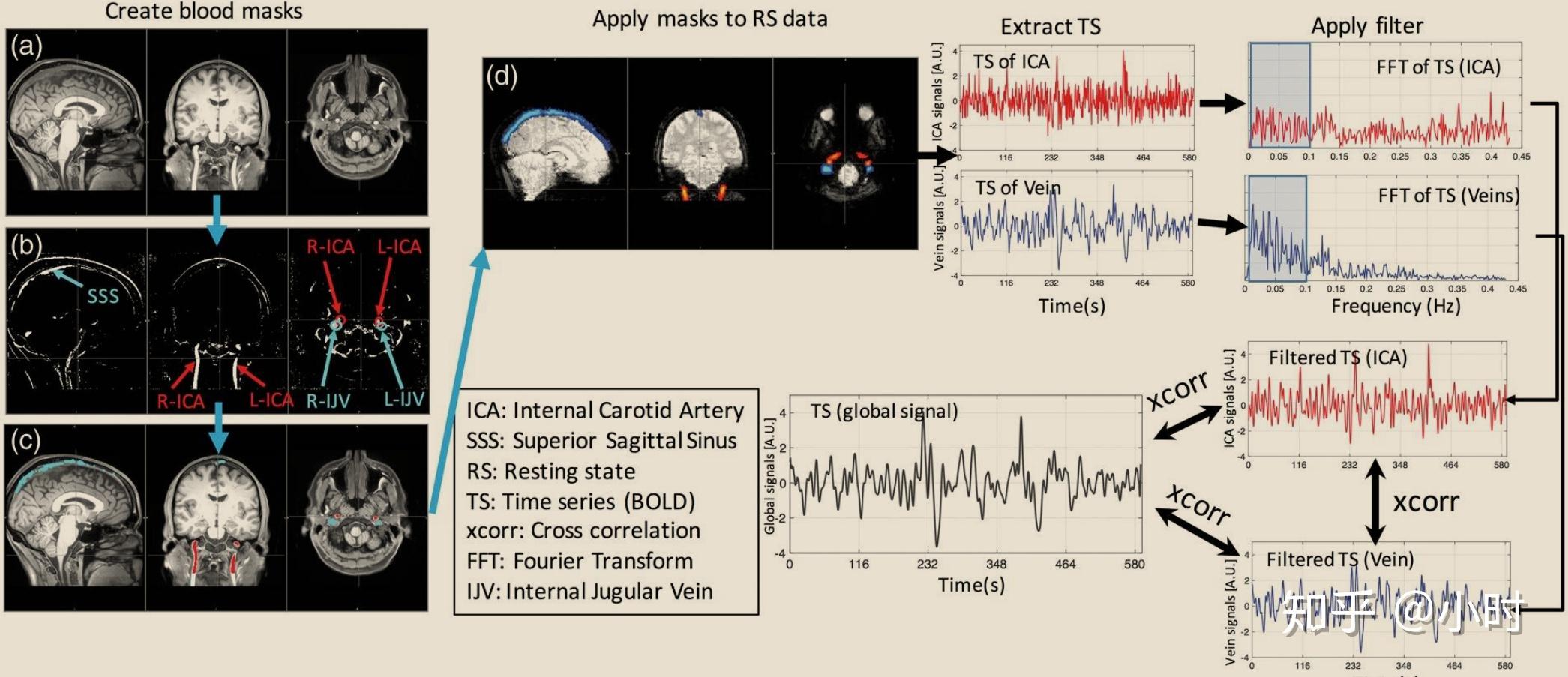 静止状态的fMRI动脉信号可预测通过大脑的不同血液传输时间 - 知乎