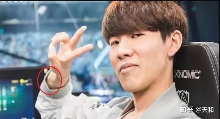 LOL：黄金右手？Faker手伤获赔600W - 知乎
