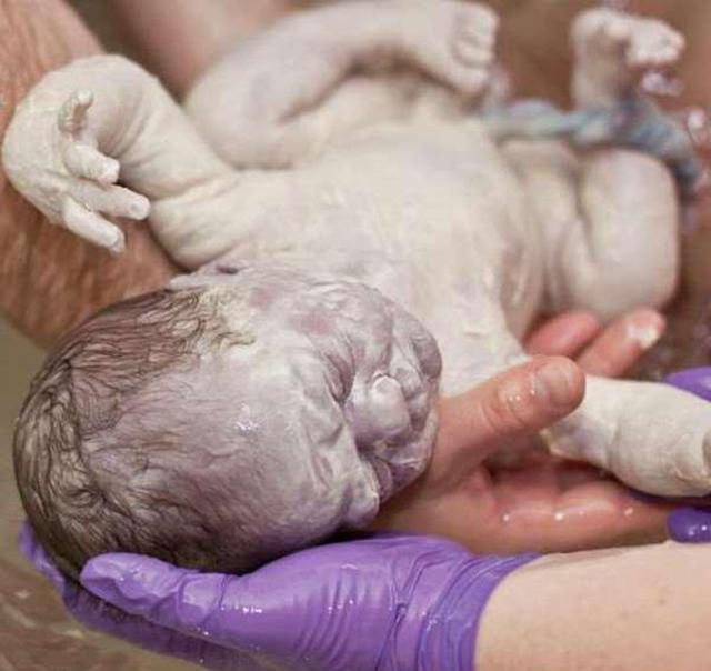 新生儿刚出生浑身雪白宝爸直接被吓哭医生却说是好事