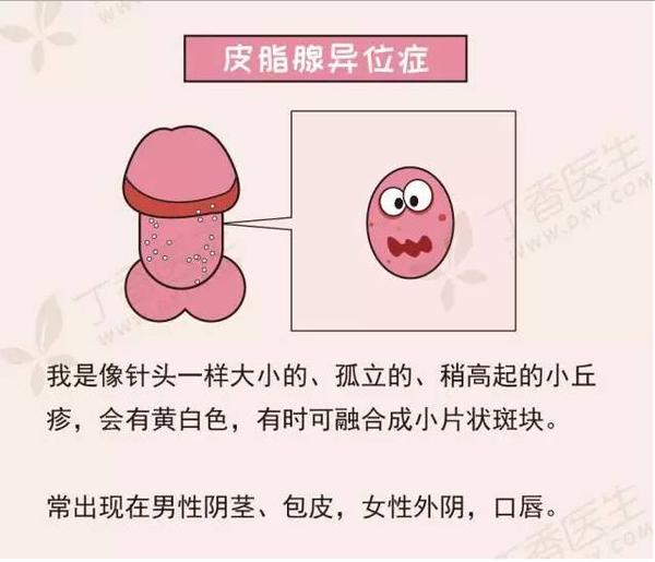 解惑丁丁上的小点点什么东东