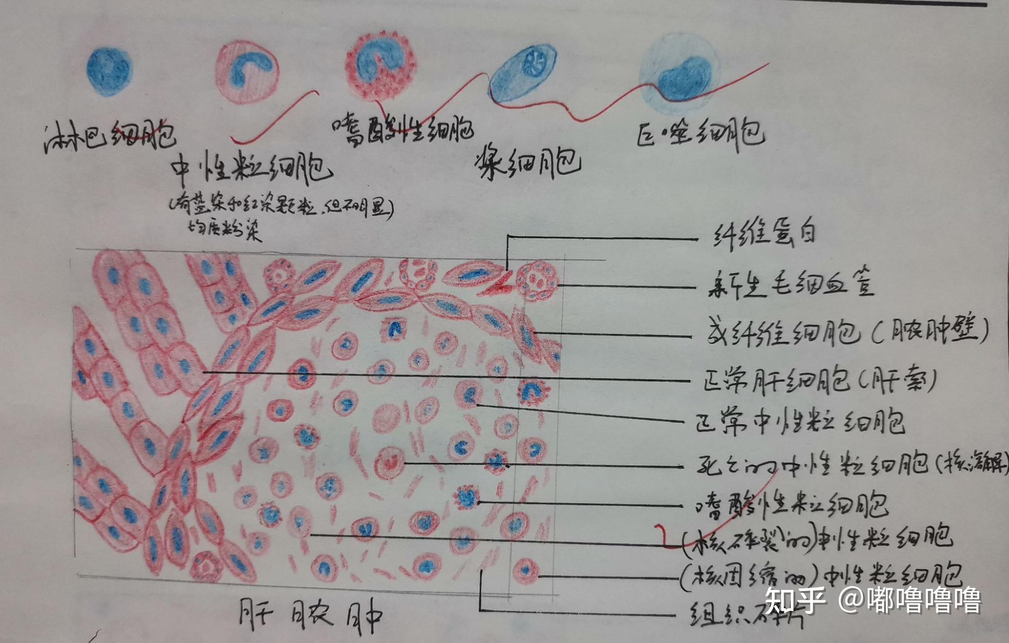 病理紅藍鉛筆手繪圖