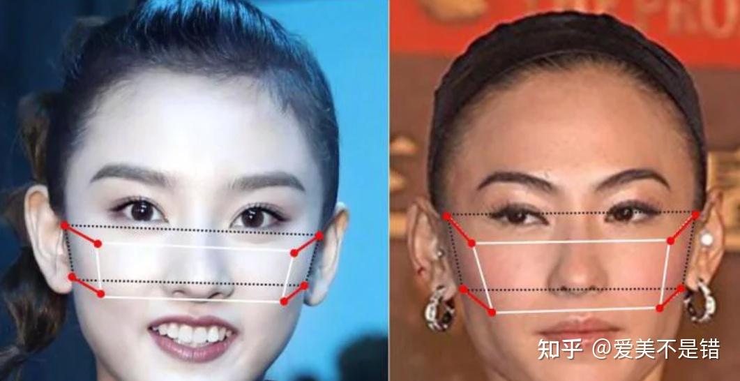 何晋龙解读:简单易懂的判断颧骨高还是颧弓宽的方法? - 知乎
