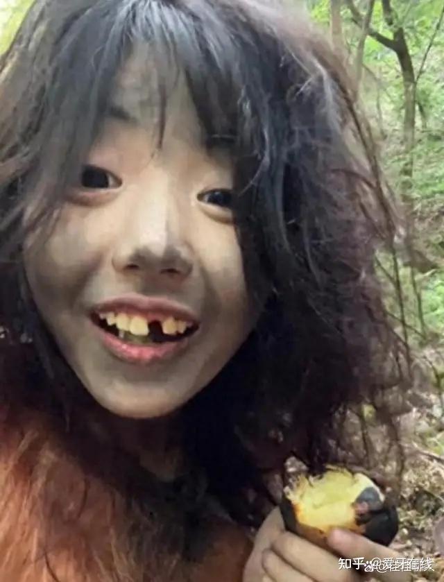 缺牙需要种牙?种一颗牙齿需要多少钱?牙齿种植过程中要注意哪些坑?