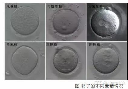 受精卵是在子宫里还是卵巢里