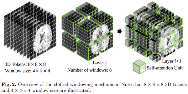 【arXiv:2201】Swin UNETR：用于 MRI 图像中脑肿瘤语义分割的 Swin Transformers - 知乎