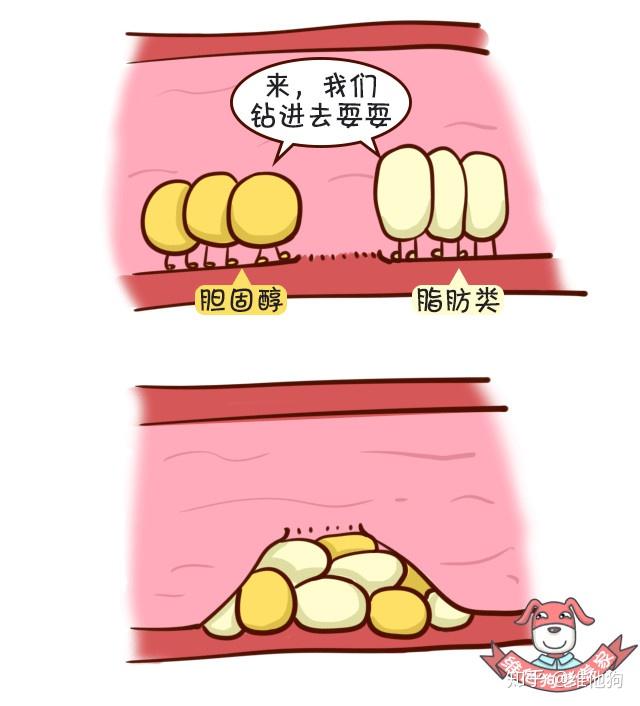 高血压认知2 高血压认知2