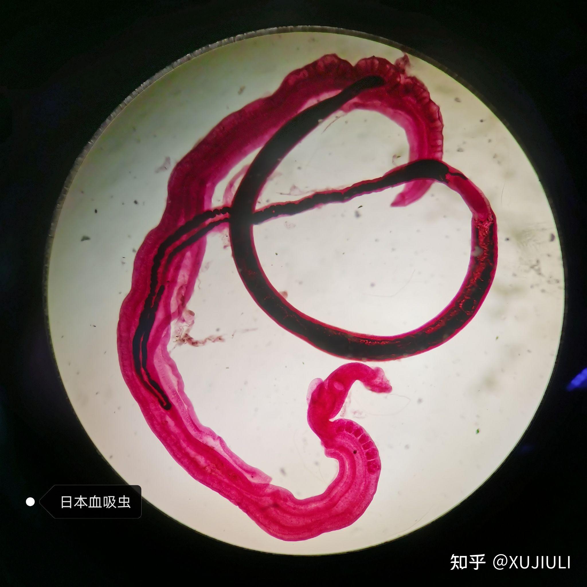 Science：寄生虫的细胞外囊泡 - 外泌体资讯网