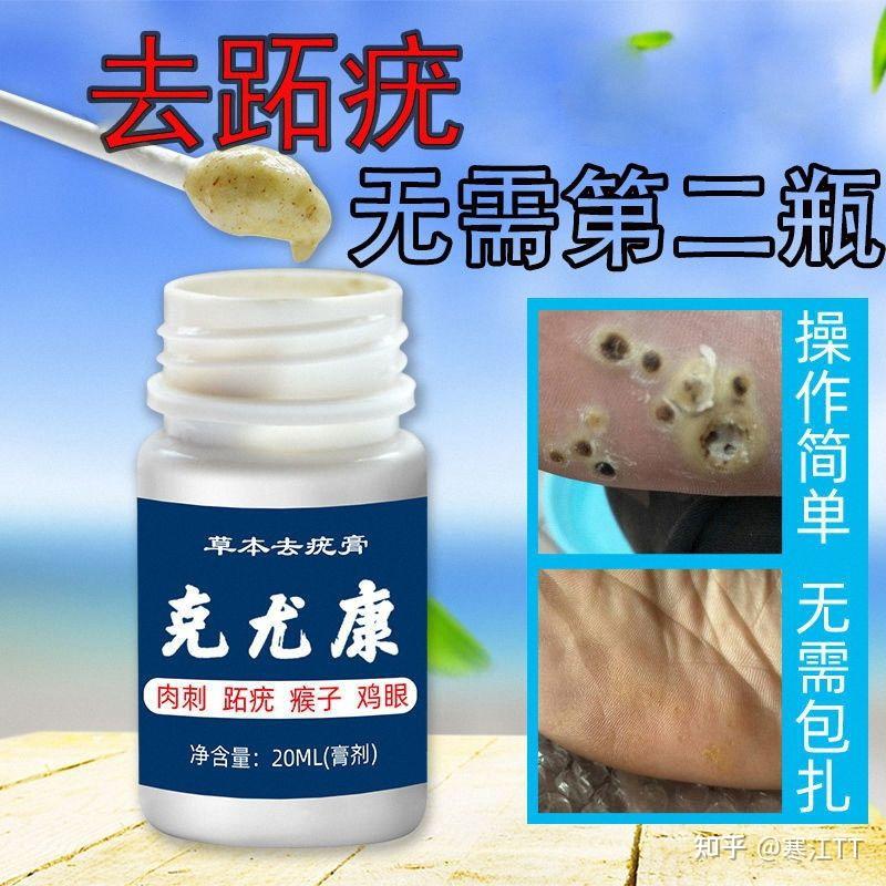 跖疣克星 - 知乎