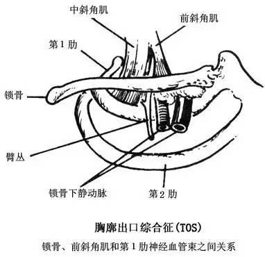 斜角肌综合征 zhuanlan.zhihu.com