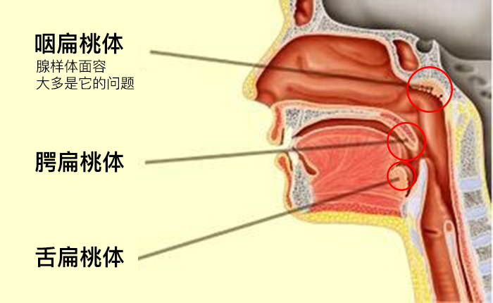 腭扁桃体和咽扁桃体图片