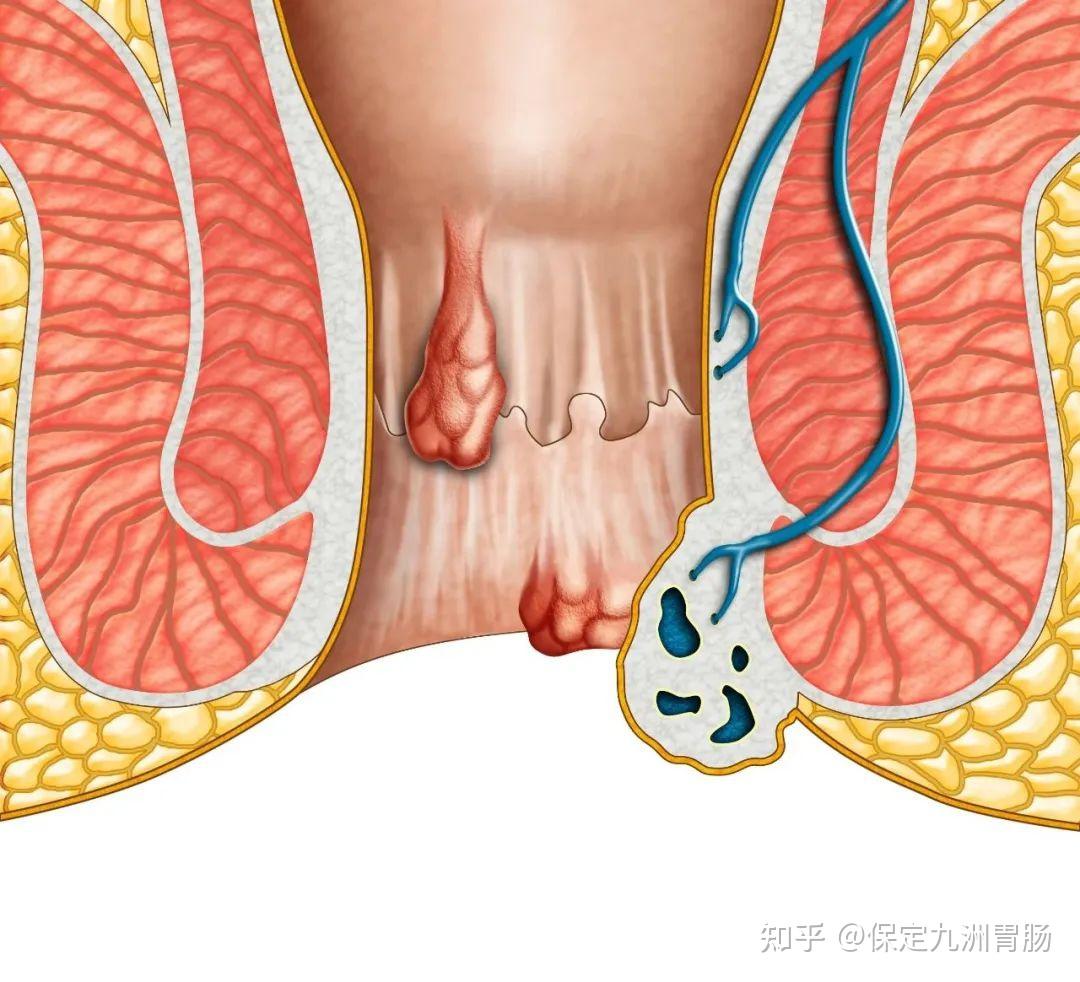 儿童大便时肛门图图片