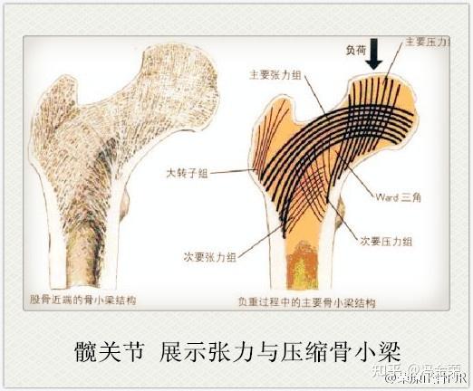 股骨骨小梁位置图图片