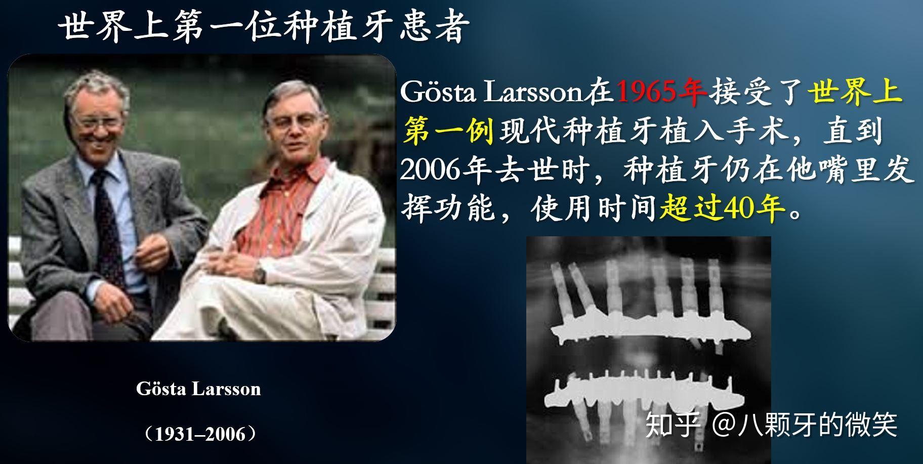 种植牙能使用多久你是不是有很多的问号