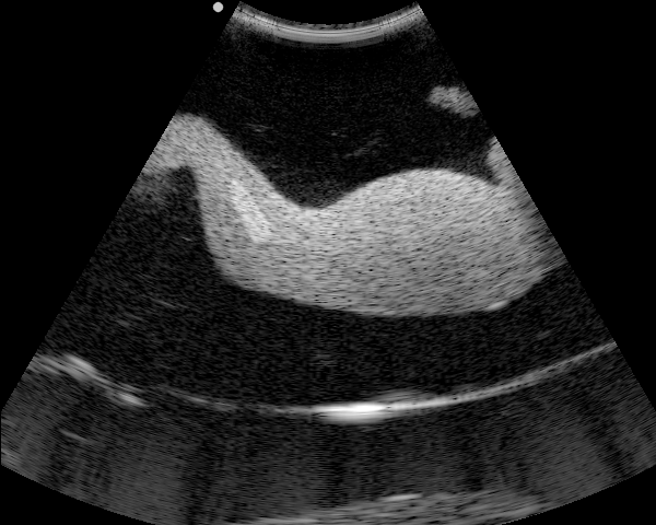 图像处理算法:Bilateral filter in Python - 知乎