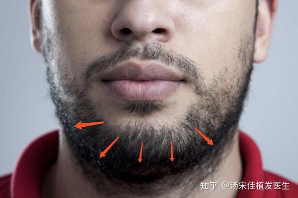 胡子可以种植吗? - 知乎