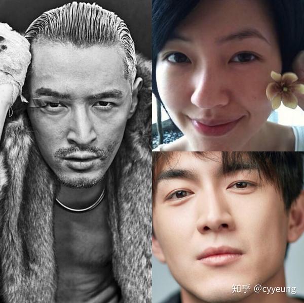 鼻骨骨折消肿后的复位是怎样进行的 如何矫正 鼻骨骨折手法复位后很疼 茶文网