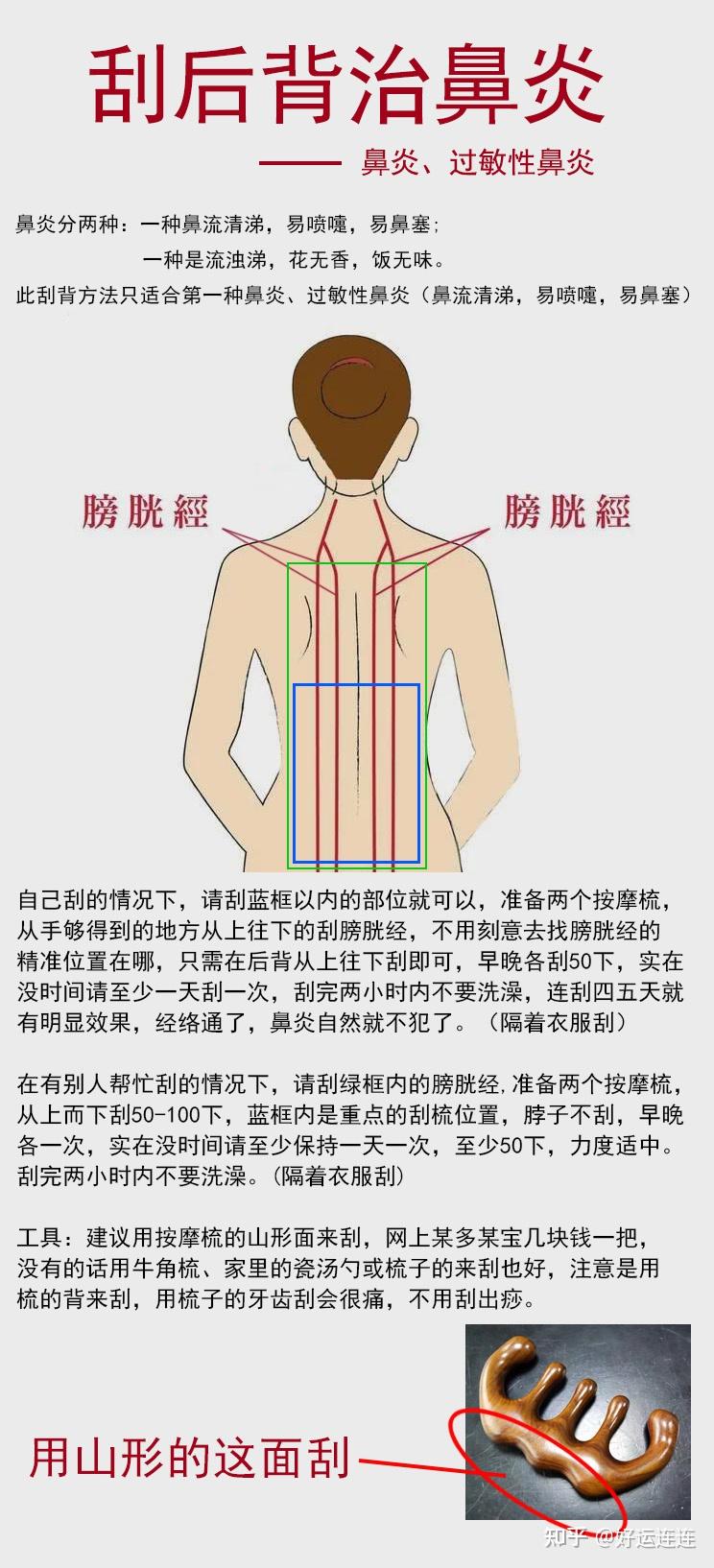 感冒背部刮痧图解图片