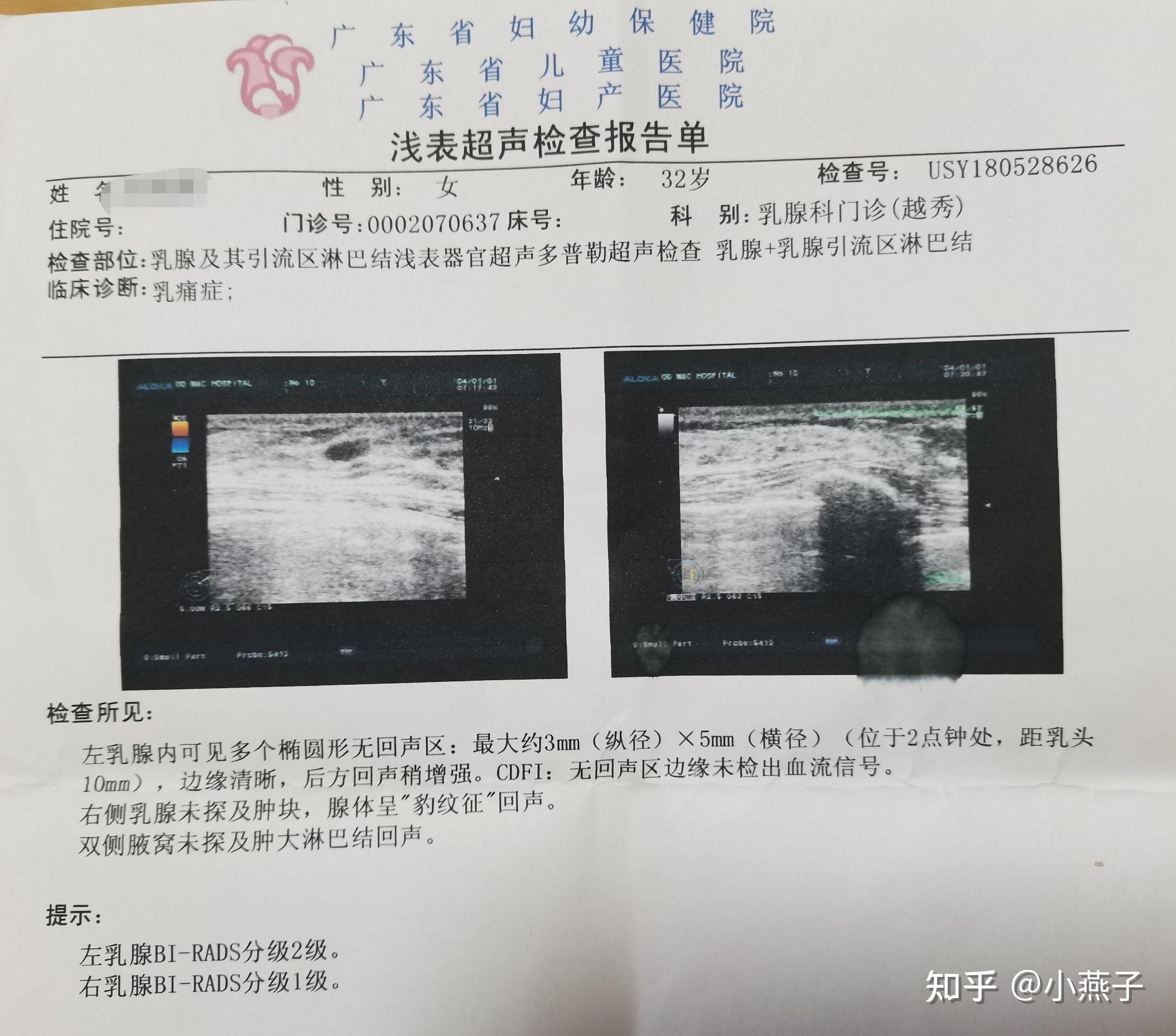 查出乳腺肿块,被医生告知要做穿刺活检的一周心路历程