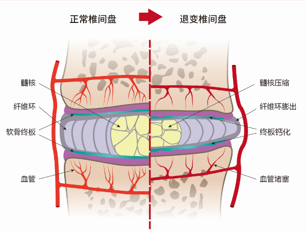 腰椎终板图片