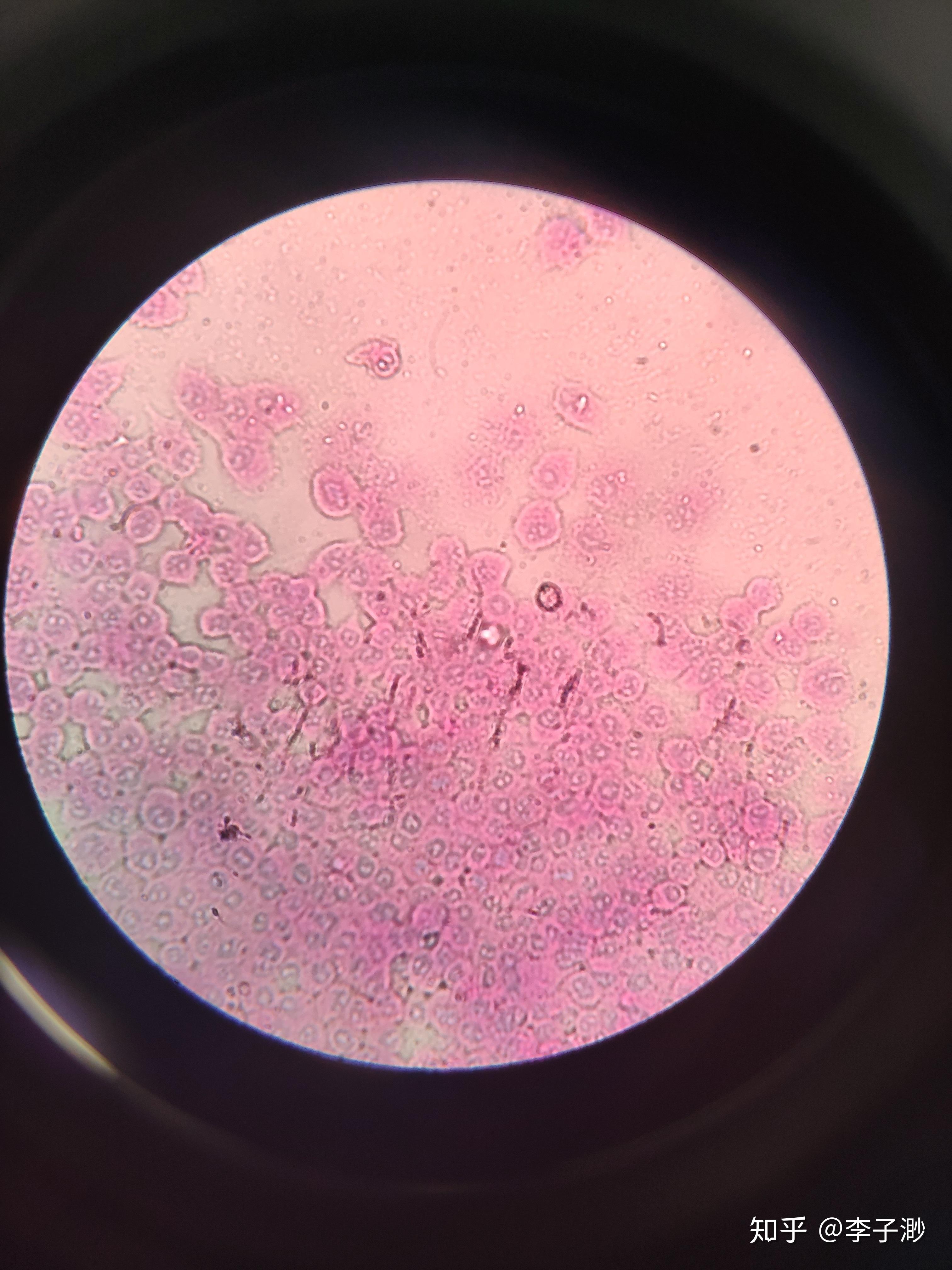 曾经造成各大实验室被细胞污染,直到如今读完这本书才算是了解了hela