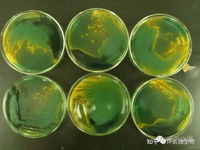 扒一扒弧菌在TCBS培养基上的显色原理 - 知乎