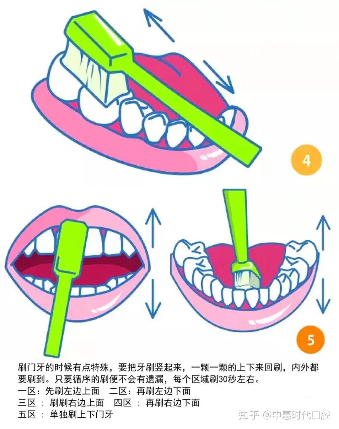 幼儿刷牙的步骤图解图片