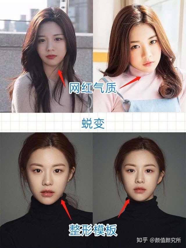 高允真如何成为新一代整容模板妈生脸