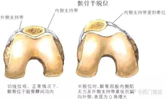 认识髌骨,波棱盖