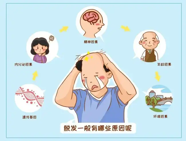 浅析米诺地尔能治脱发吗哪一个牌子生发好