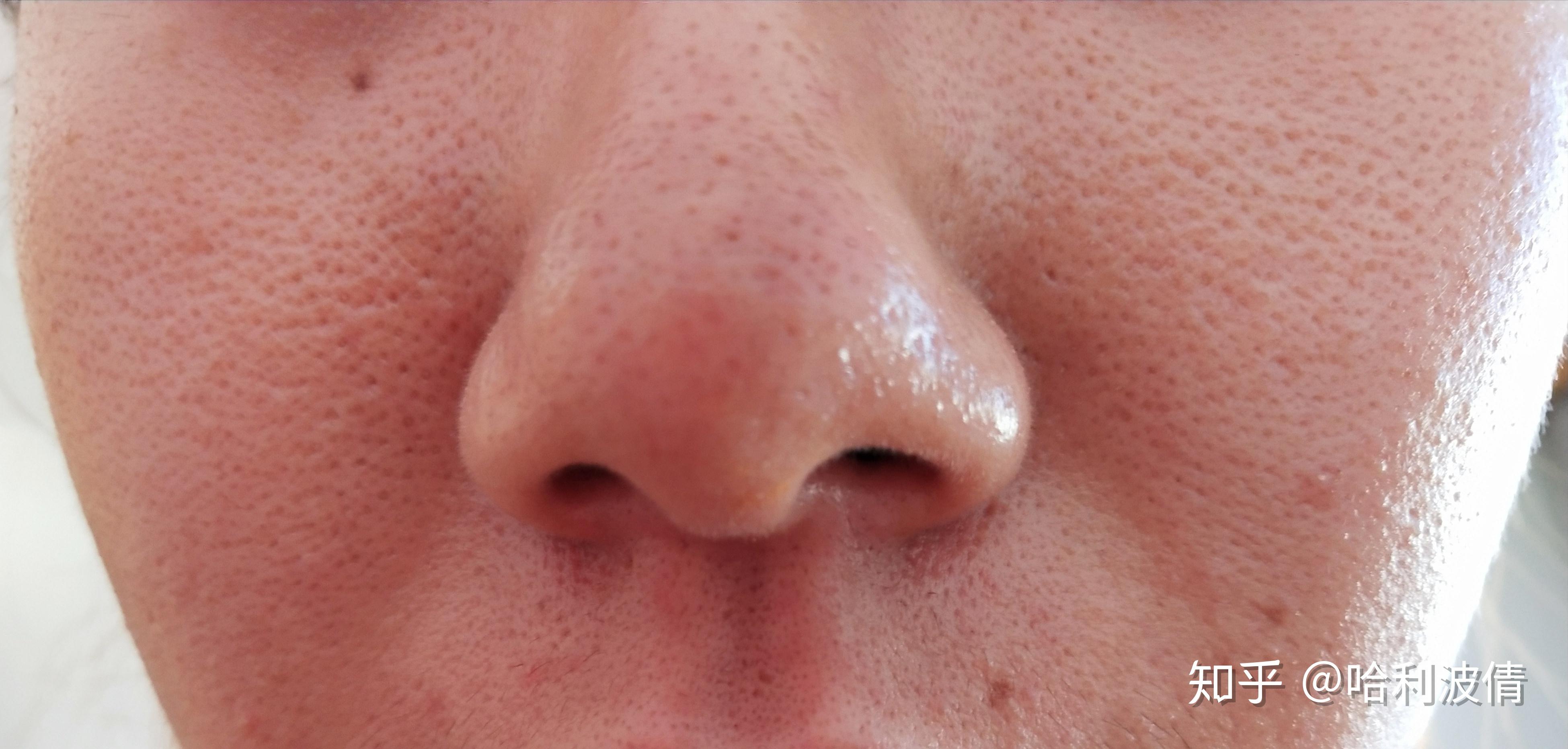 水滴鼻、直鼻，翘鼻，哪种鼻型适合你 - 知乎