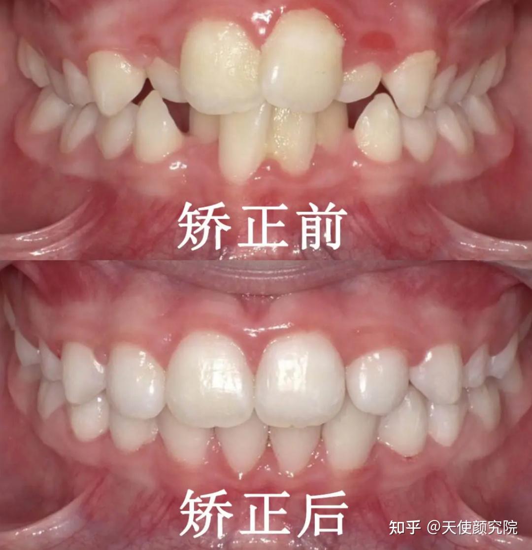 郑秀妍这段太蛊了吧!芒果台怎么能删了不播??!(郑秀妍签约英皇)