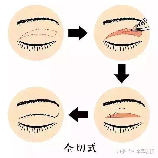 v2-6b479c328c76dd56ff0eedd838d2ee63_r.jpg