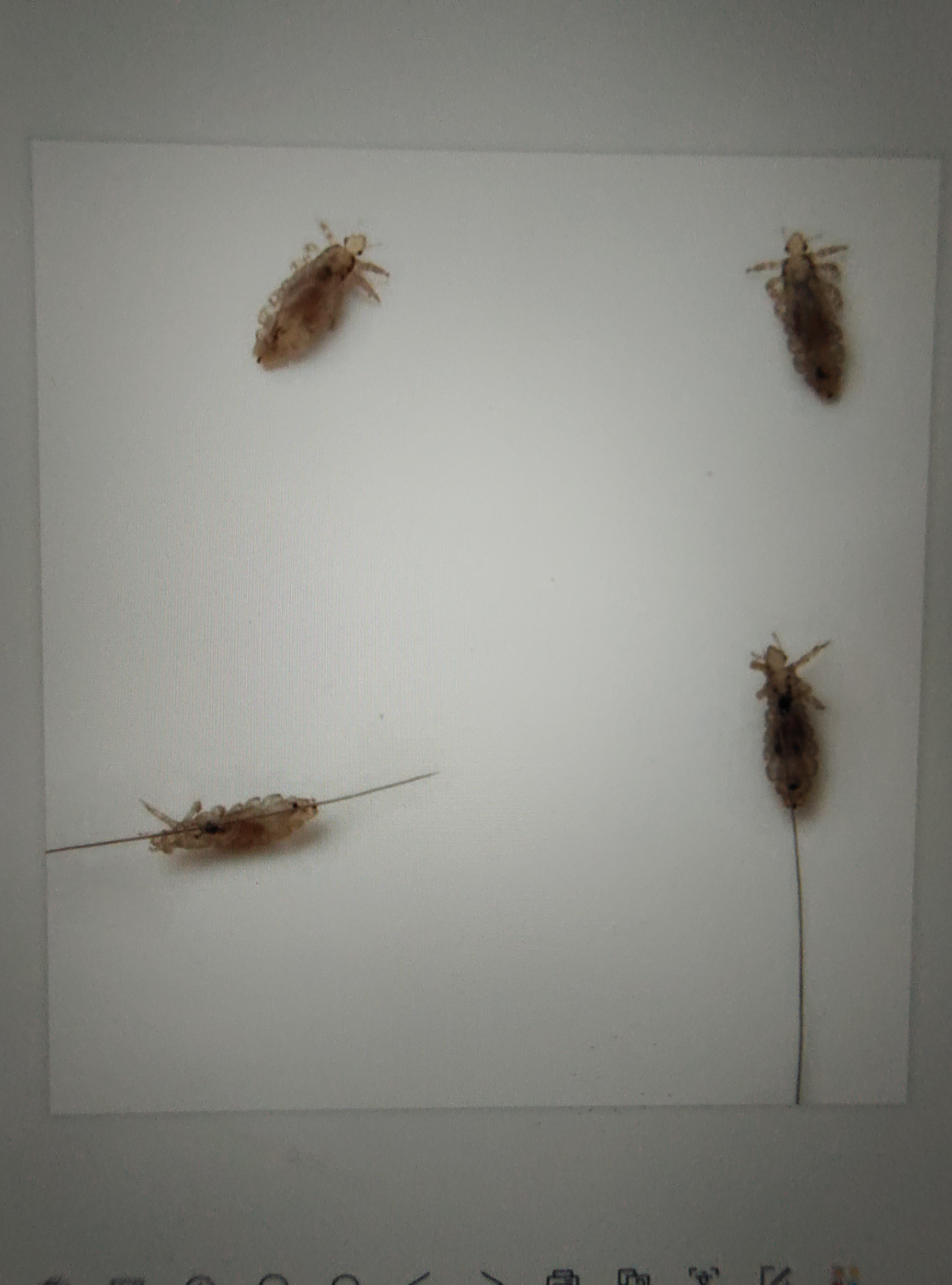 虱类俗称虱子,属昆虫纲虱目(anoplura)人虱科 (pediculidae),是一类