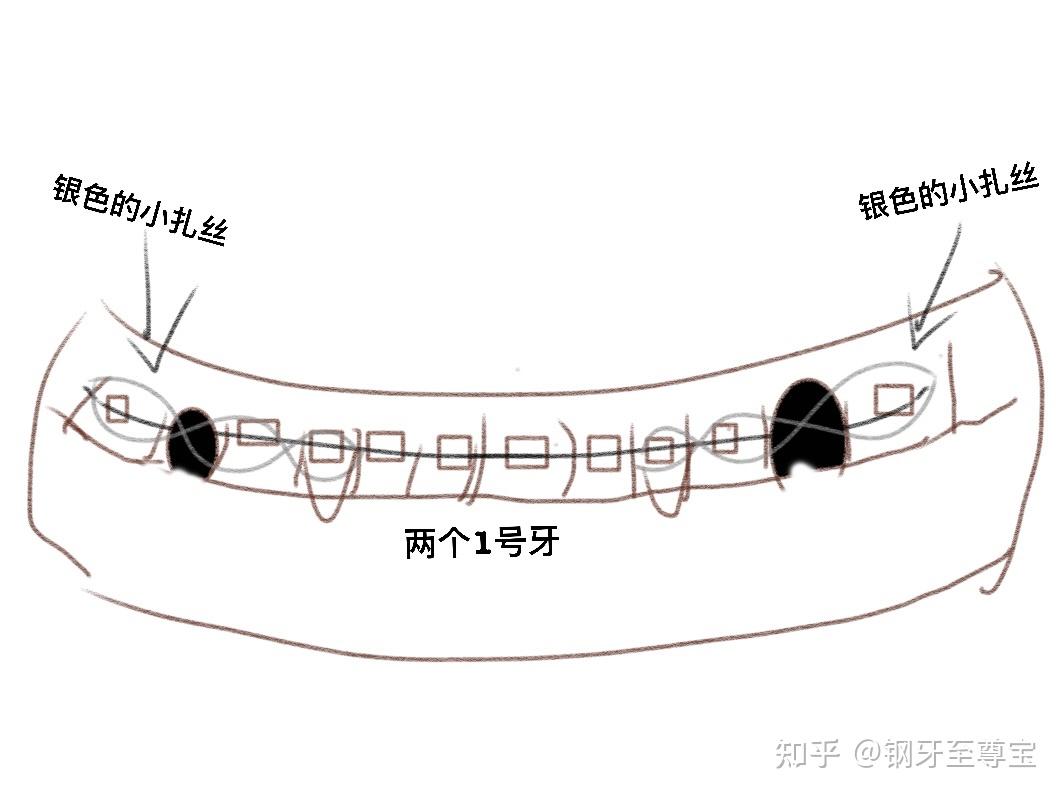 不同的是这次拔完牙后,解锁了新的小道具"八字结扎",大概就是下图那样
