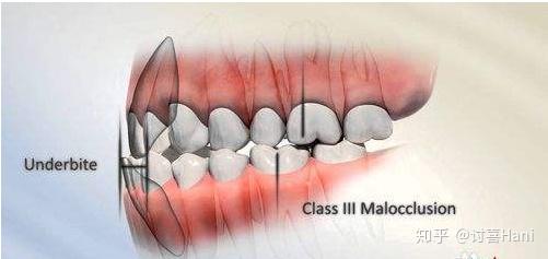 v2-6b9bcc4340eacb896cc12ca7aead1e7f_r.jpg