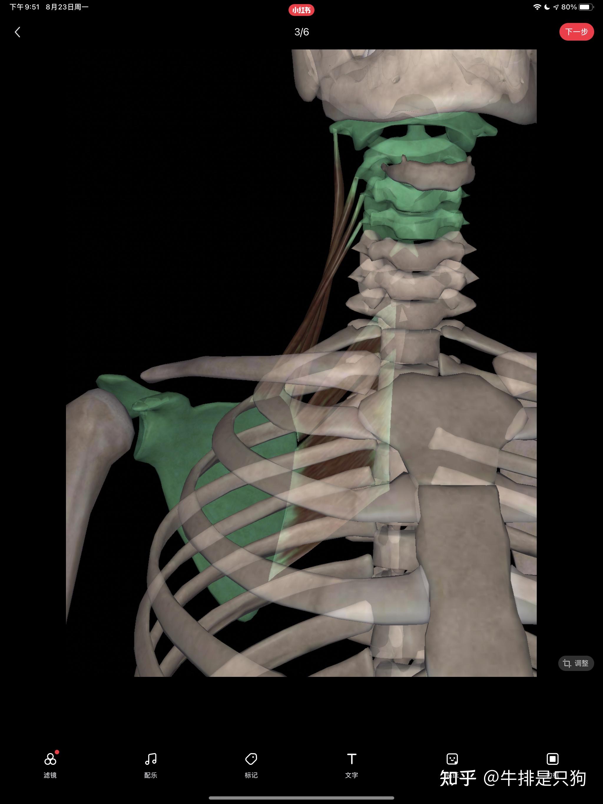 图8-34 胸廓内动脉示意图-临床应用人体结构-医学