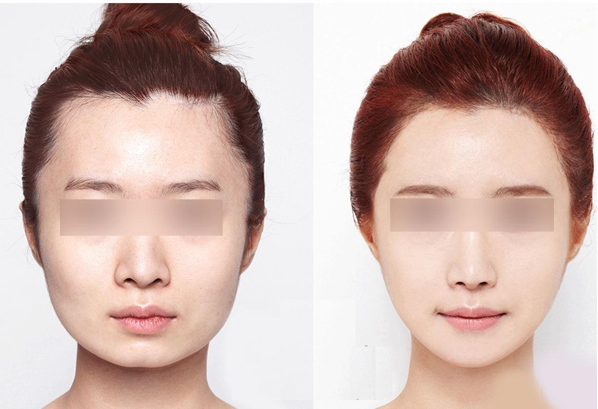 女生脸大怎么办这三个原因你要知道不然钱花再多也没效果