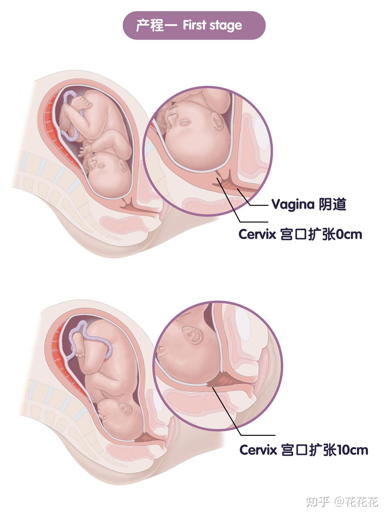 顺产的三个产程以及注意事项