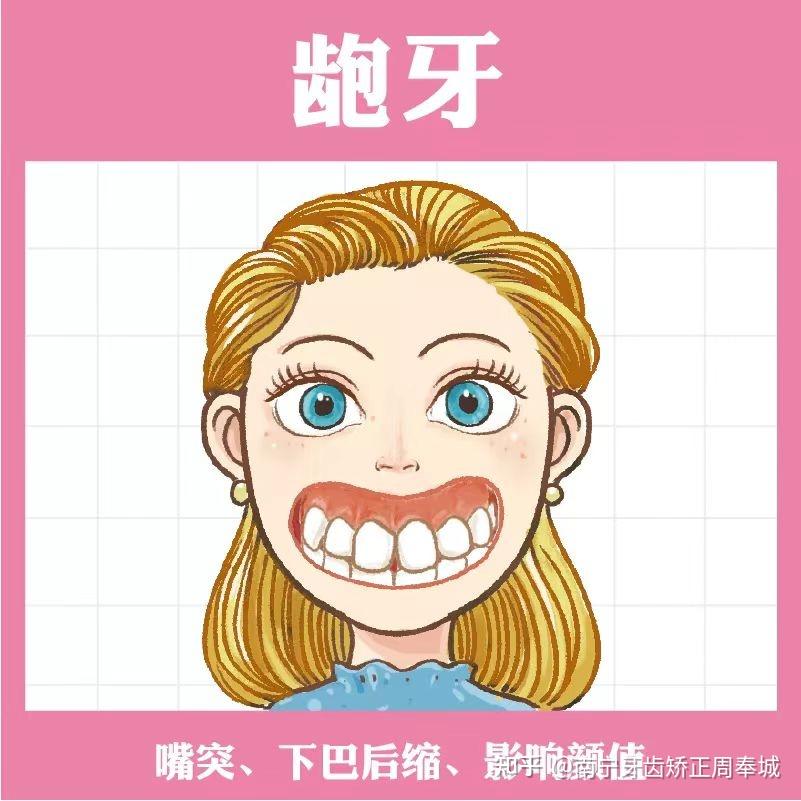 南宁牙齿矫正|龅牙显老是不是真的?说出来你可能不信