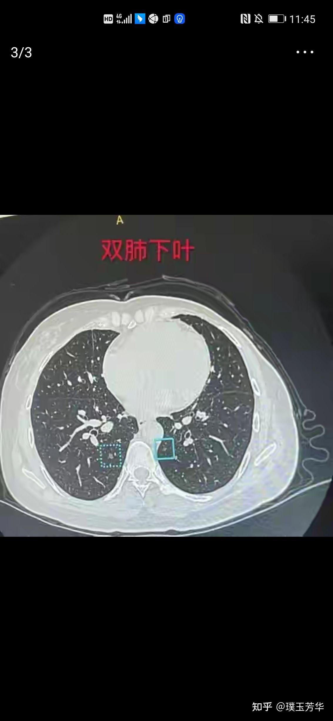 戴纪刚预约挂号(戴纪刚医生放号时间)