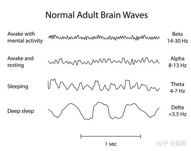 脑电信号概述 - 知乎
