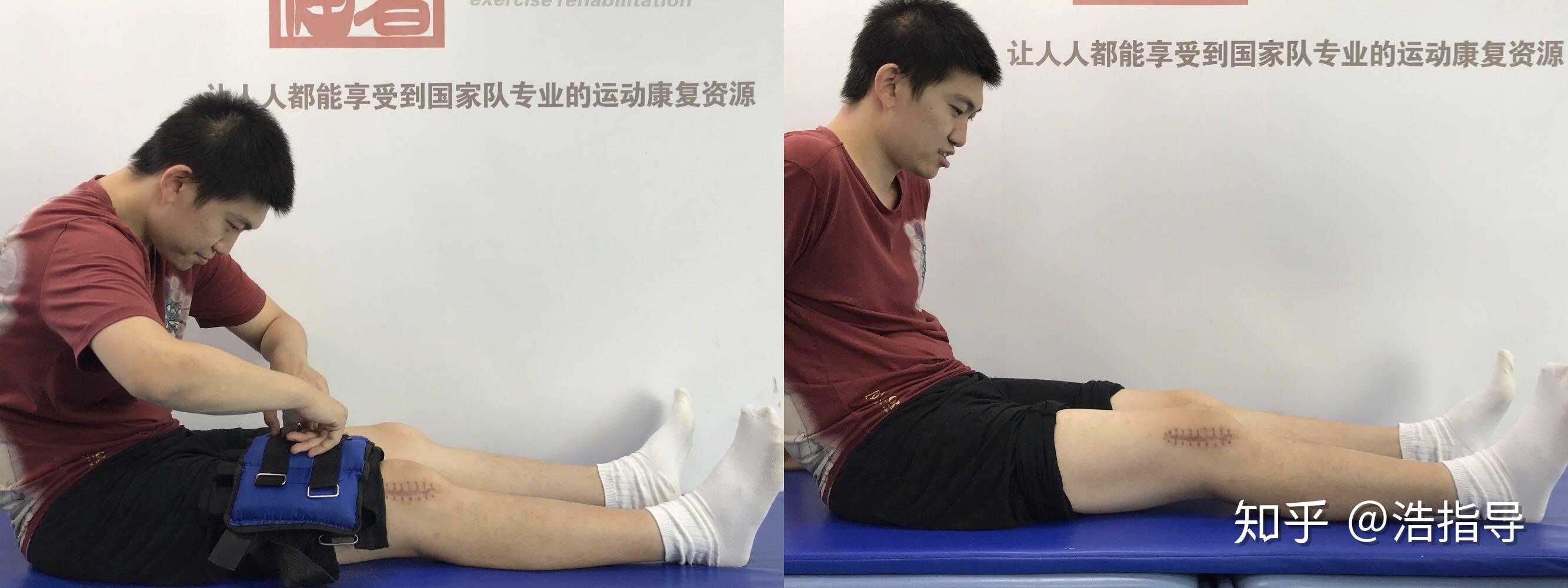 警惕你以为的腿伸直了可能还没直两招自我判断是否存在伸直受限