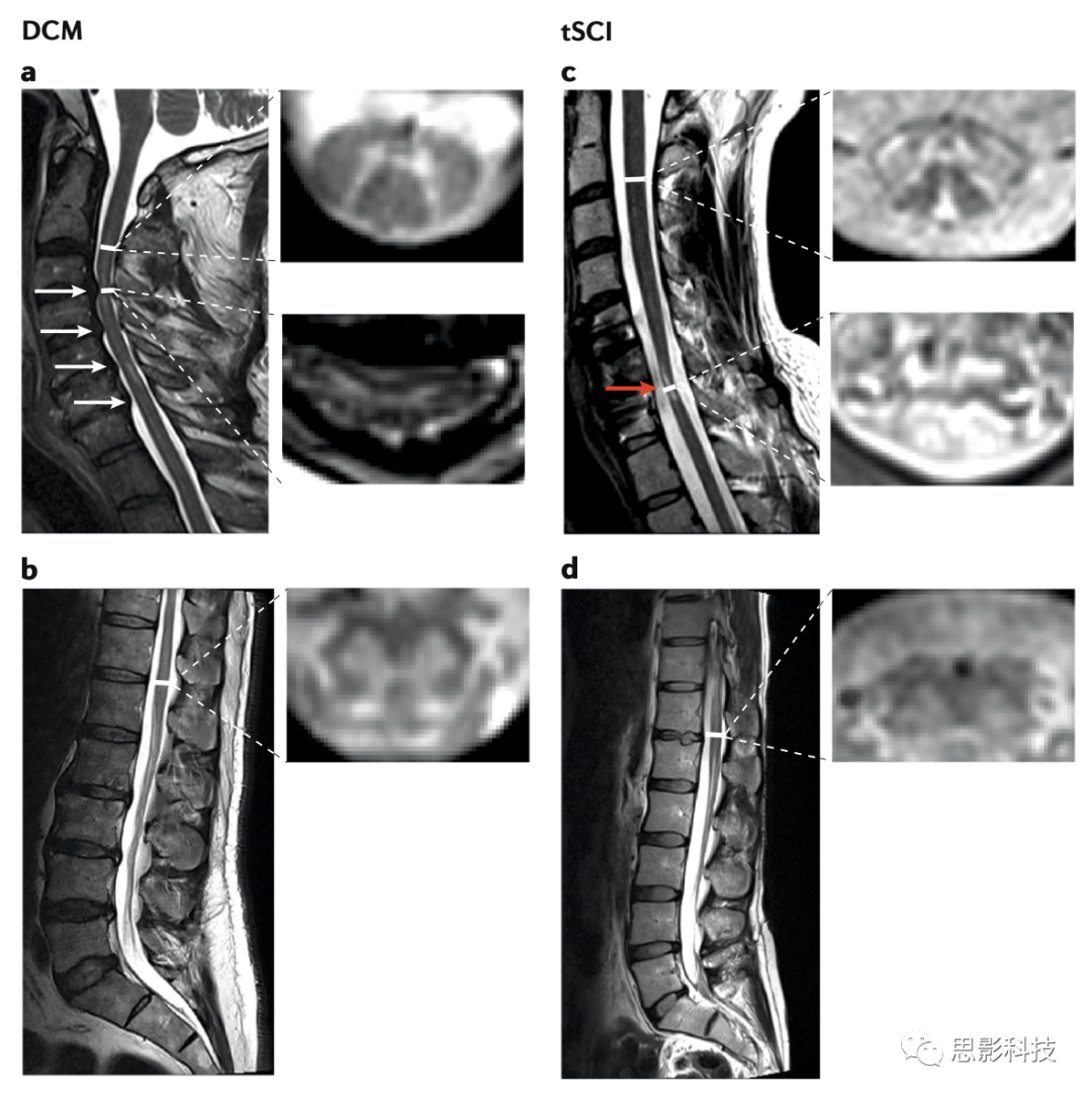 【图谱】脊髓、脊柱、脊神经高清解剖图_韧带