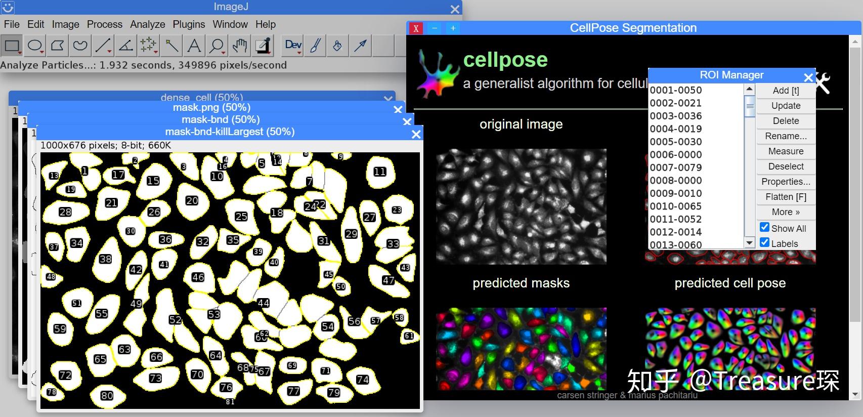 imagej实用教程—网页版imagej 知乎