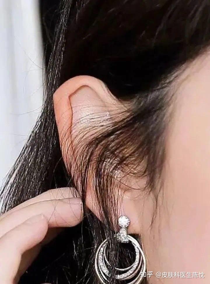 一个好的轮廓针的很抓人眼球那么也侧面体现出了耳朵对于面部美学的