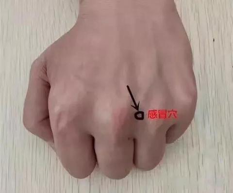 针灸