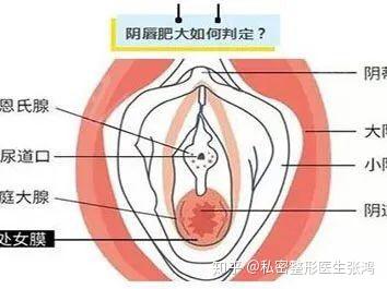 请关注一下小阴唇过于肥大女性 为何她们的痛苦无法启齿 知乎