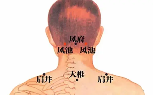 针灸医家取“风池穴”经典医案 - 知乎