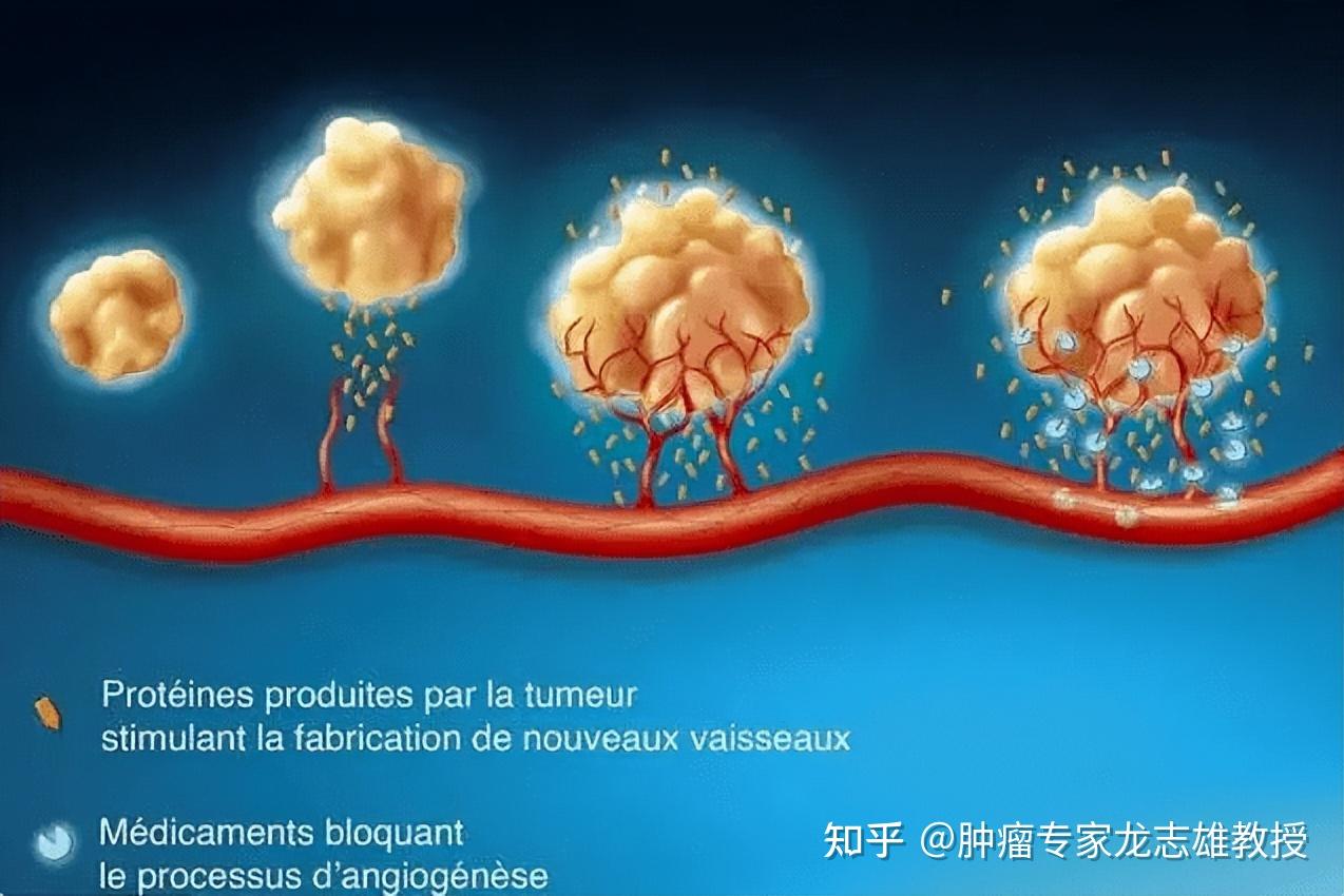 肿瘤热疗,第五大肿瘤治疗手段