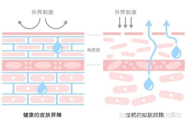 【真实案例】秋冬来临,你是不是也正在被敏感肌困扰?! - 知乎